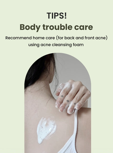 Matcha Biome Amino Acne Cleansing Foam (150g)