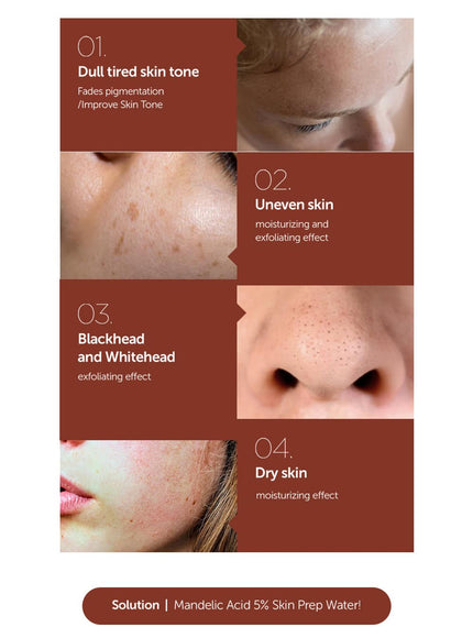 Mandelic Acid 5% Skin Prep Water Trio Set (120ml*3ea)